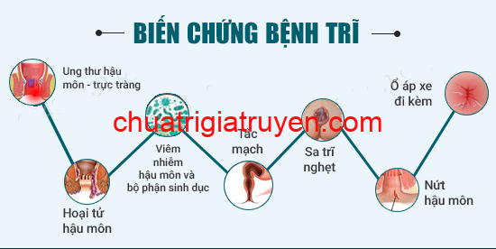 Các biến chứng của bệnh trĩ