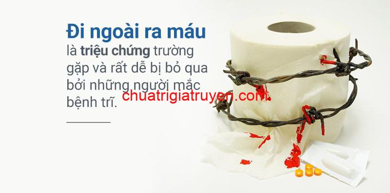 Triệu chứng bệnh trĩ