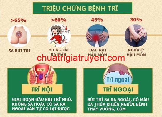 Các triệu chứng của bệnh trĩ