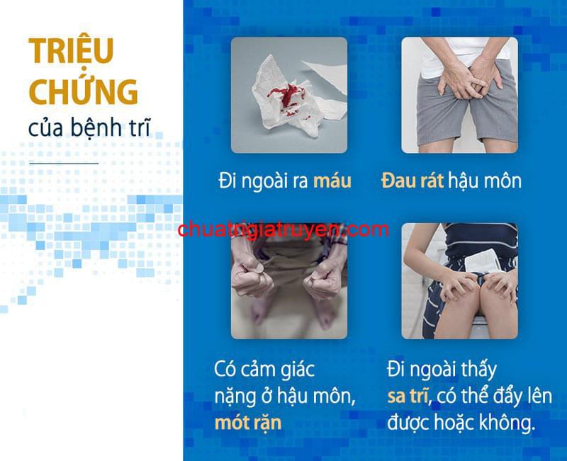 Triệu chứng của người bị bệnh trĩ